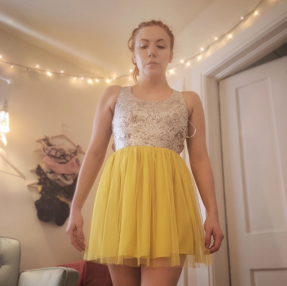 UO dress